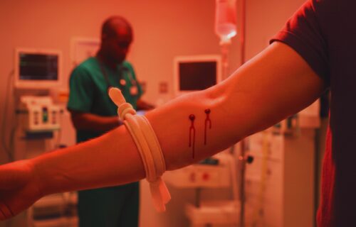 Snakebite Emergency Pretoria, Johannesburg and Magaliesberg Hospitals 2026